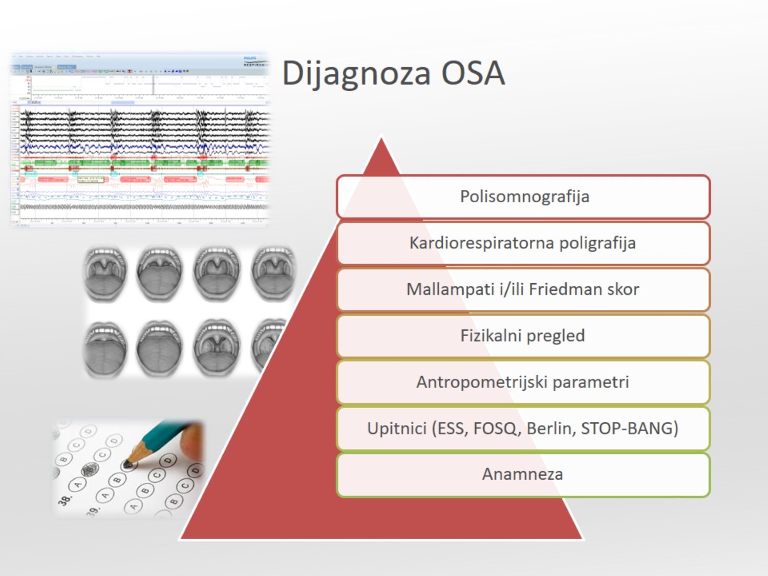 Infografika: dijagnoza OSA — hijerarhija od anamneze, upitnika (ESS, FOSQ, Berlin, STOP-BANG), antropometrije, fizikalnog pregleda, Mallampati/Friedman skorа, do kardiorespiratorne poligrafije i polisomnografije